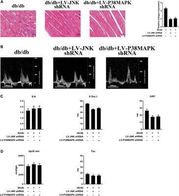 Ivabradine Ameliorates Cardiac Diastolic Dysfunction in Diabetic Mice Independent of Heart Rate Reduction